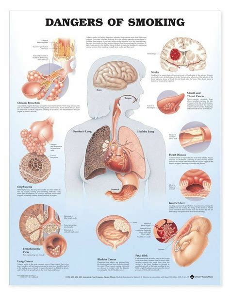 dangers of smoking anatomical chart laminated