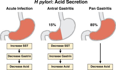 Control Of Gastric Acid Secretion In Health And Disease