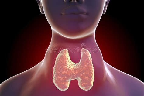 Hyperthyroidism And Hypothyroidism Female With Signs And Symptoms Of