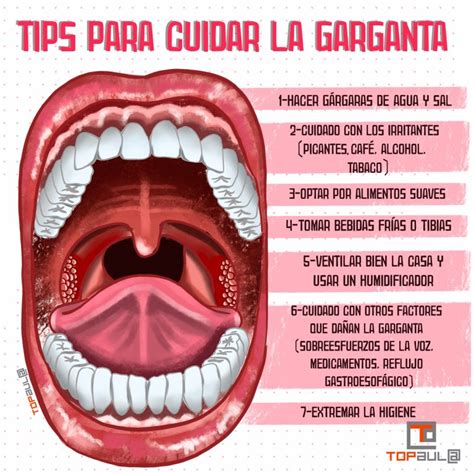 Faringitis Y Amigdalitis Tips Para Cuidar La Garganta Top Aul