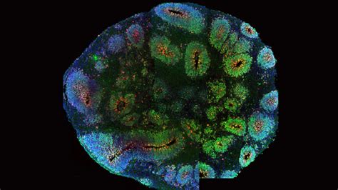 Lab Grown Organoids Are More Stressed Out Than Actual Brain Cells