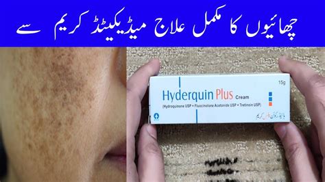 Hyderquin plus hyderquin benefits in urdu hyderquin plus cream price in pakistan zarine khan. How To Use Hyderquin Plus Cream For Pigmentation.Get Fair ...