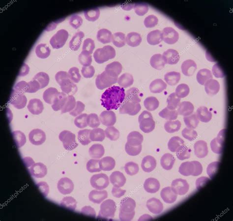 White Blood Cells — Stock Photo © Toeytoey 126132168