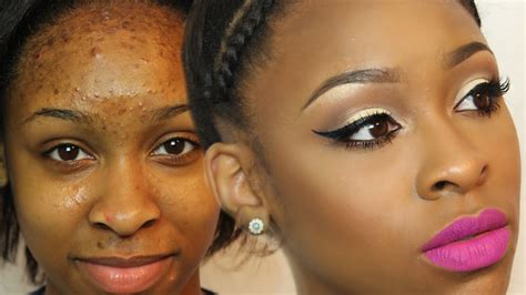 How To Cover Acne Scars And Bumps Makeover Monday Makeup