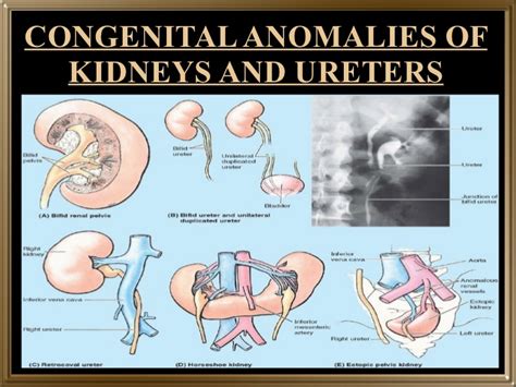 Kidney Pain Causes Location Symptoms And Treatment