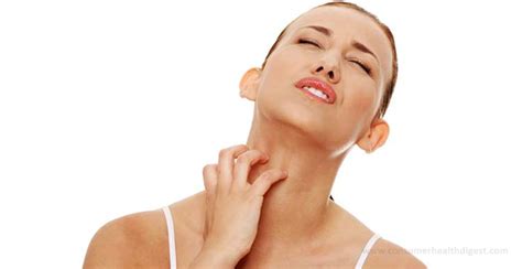 Rash On Neck Facts Causes Symptoms Treatments And More