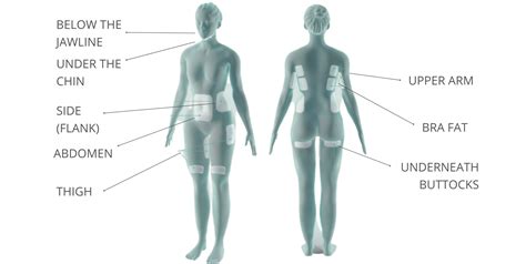 Coolsculpting Fda Approved Areas Gentle Touch Medispa