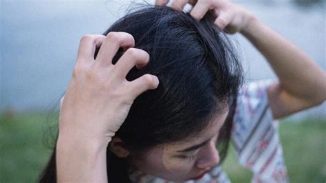 Itchy Scalp Causes Symptoms And Treatment