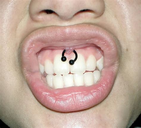 Nice Single Gum Piercing With Circular Ring