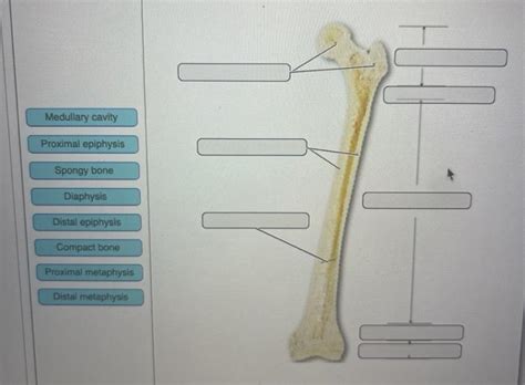 Solved E Medullary Cavity Proximal Epiphysis Spongy Bone