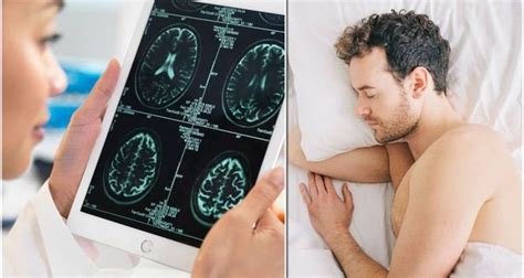 Expert Shares The Sleeping Position That Could Slash Risk Of Alzheimers And Parkinsons