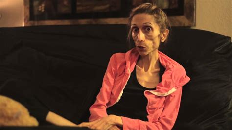 Anorexic Actress Begs For Help The Edge 961 Beats That Move You