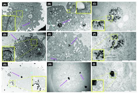 Tem Images Of Intracellular Agnps The Images Show The Intracellular