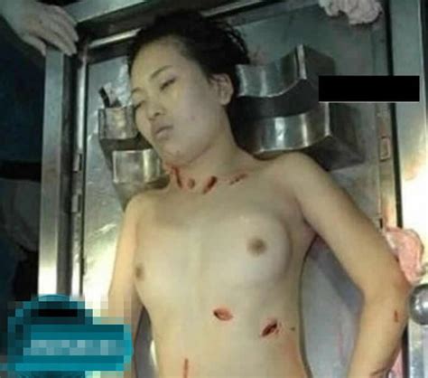 レイプ後刺殺された若い女性の全裸死体 検査のためマンコ開いて膣内を撮影される カルログローチェ