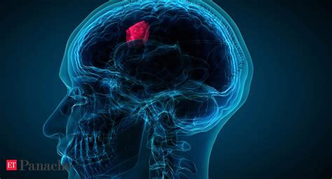 New Algorithm Can Find Treatment To Deadly Brain Cancer The Economic