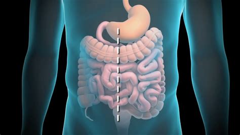 It is divided as follows: Colon Resection - YouTube