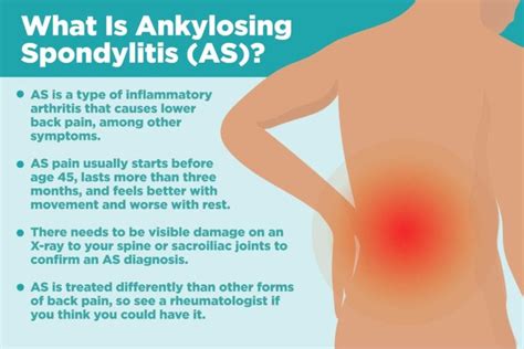 Ankylosing Spondylitis About Causes And Treatments Creakyjoints