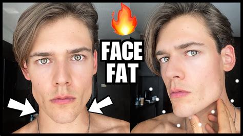 How To Lose Face Fat And Chubby Cheeks Fast Get A Chiseled Face And Jawline Guaranteed Youtube
