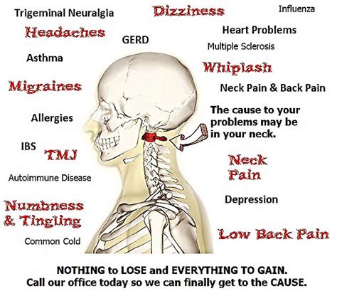 Upper Cervical Chiropractic In South Florida