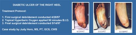 Bruce Levine Dpm Harbor Foot And Ankle Podiatric Medical Group
