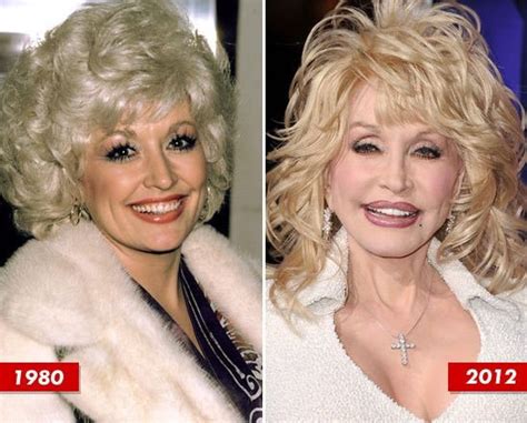 Dolly Parton Queen Of Plastic Surgery