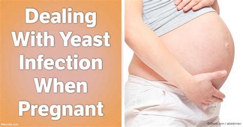 dealing with a yeast infection during pregnancy
