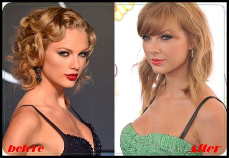 Taylor Swift Breast Implants Surgery Before And After Boob Job Photos Plastic Surgery