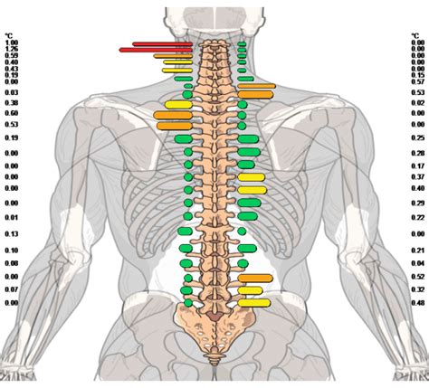 Gohl Clinic Of Chiropractic In Carlsbad Severe Low Back Pain