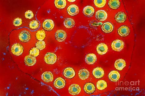 Herpes Virus Photograph By Science Source Fine Art America
