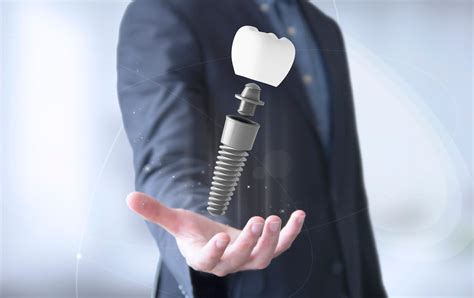 Os Implantes Dentários Estão Mais Seguros No Brasil