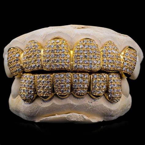 Real Diamonds Round Diamond Teeth Grillz Weight Custom At Rs 49999piece In Surat