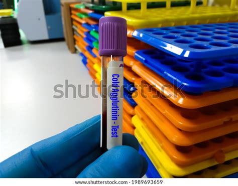 Blood Sample Tube Cold Agglutinin Disease Stock Photo 1989693659