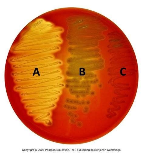 9 Which Of The Following Is An Alpha Haemolytic Bacteria Luke Has Stanley