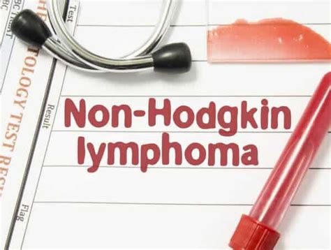 Astro awani 244 views6 year ago. Limfoma Bukan Hodgkin (Non-Hodgkin's Lymphoma) - Jenis ...