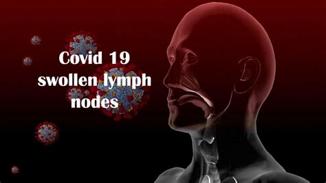 Covid 19 Swollen Lymph Nodes Latest Research Information