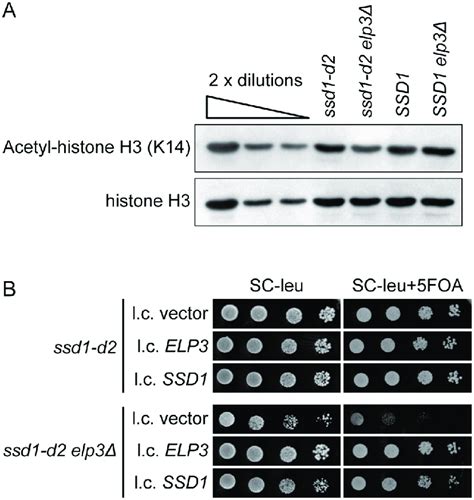 The Ssd1 D2 Allele Is Required For The Histone Acetylation And
