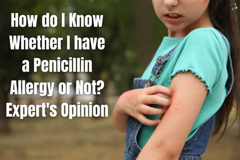 How Do I Know Whether I Have A Penicillin Allergy Or Not Experts