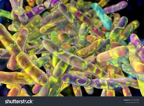 Bacteria Bifidobacterium Grampositive Anaerobic Rodshaped Bacteria