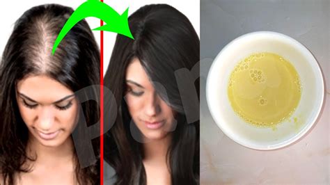 How To Hair Grow Thicker And Longer Thicker Fast Naturally With 3