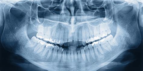 احصل على أفضل الصور التشريحية الشعاعية للأسنان مع تطبيق X Ray Mobile