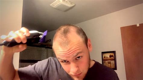 Receding Hairline Since 17 Shaving My Head Embracing Going Bald Live