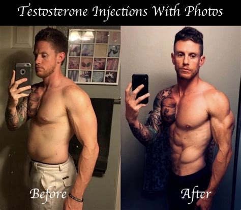 Testosterone Injections Before And After Photos Hgh