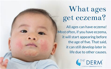 Eczema What To Know And Treating It Well In Children And Adults The