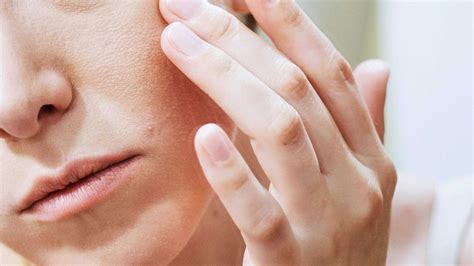 eczema cauze simptome tratament consultatii online getvig health