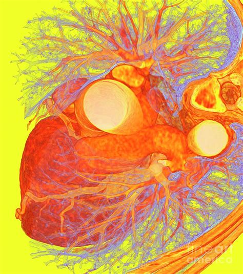 Human Heart Photograph By K H Fungscience Photo Library Pixels