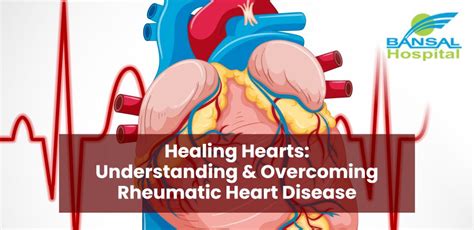 Healing Hearts Understanding And Overcoming Rheumatic Heart Disease