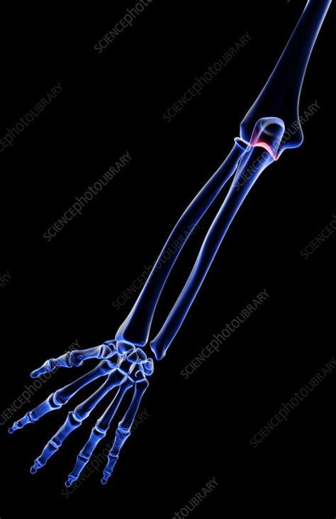 The Bones Of The Forearm Stock Image F0015145 Science Photo Library