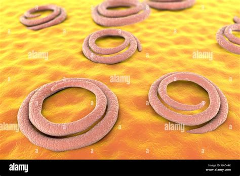 Trichinella Spiralis Roundworm Hi Res Stock Photography And Images Alamy