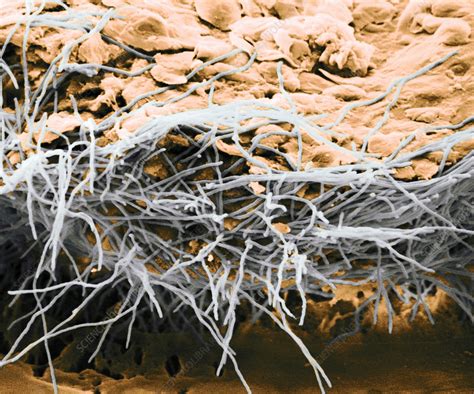 Hyphae On Human Skin Sem Stock Image C0283631 Science Photo Library