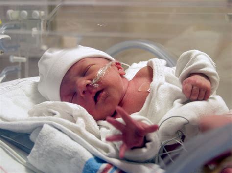 Pictures Of Premature Babies Born At 32 Weeks Picturemeta